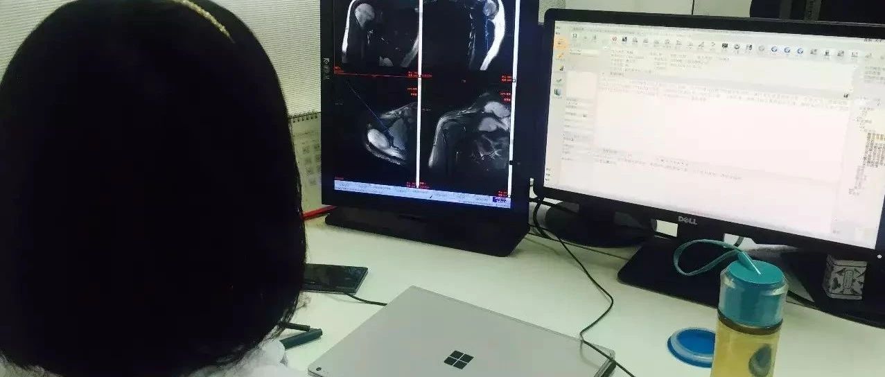 頂刊Radiology：ChatGPT可以審核影像報告，且能力優於主治醫師！