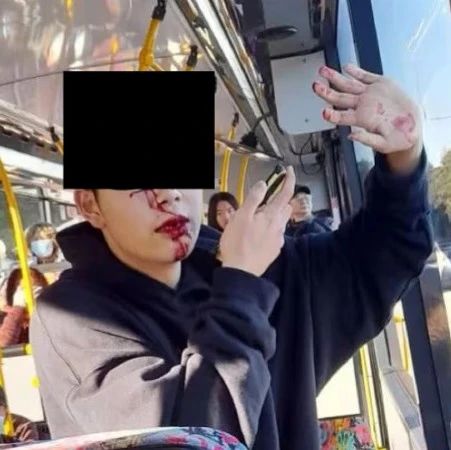 中國留學生，公車上突遭女子襲擊！“5顆牙被打掉”